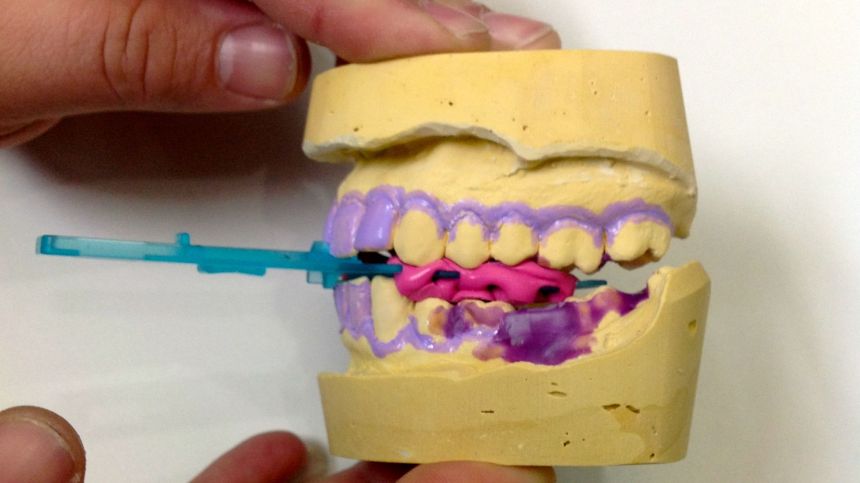 konstrukcijski zagriz antihrkalica